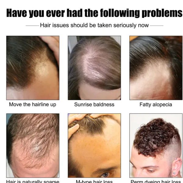 Men's Hair Growth Essence